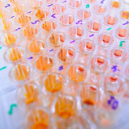 Sample tubes for Antibiotic sensitivity test
