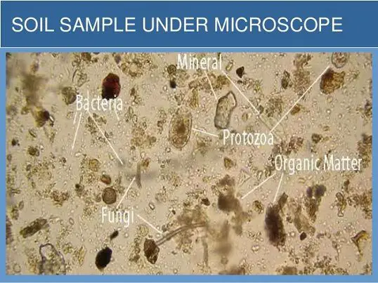Electron microscope picture showing microbes like bacteria, fungi and protozoa