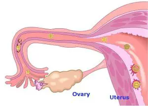 ovary, uterus