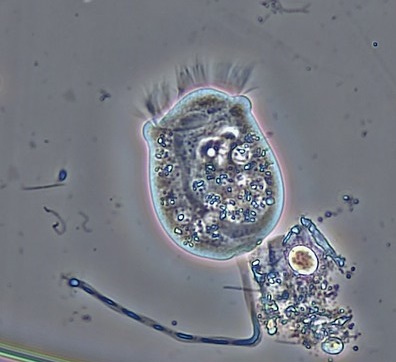 Vorticella a protozoan