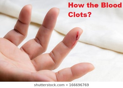 What is Hemostasis