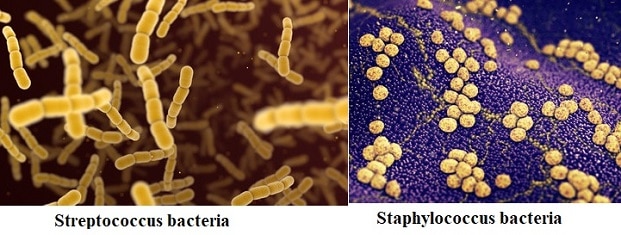 Streptococcus vs Staphylococcus