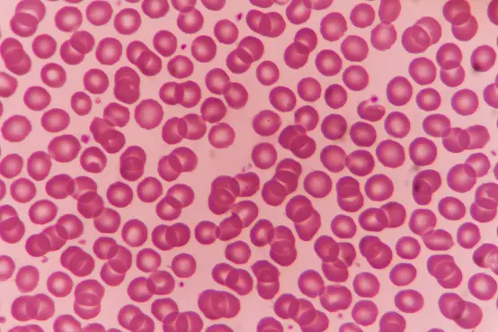 Red blood cells under microscope