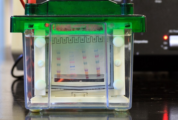 Chromatography vs Electrophoresis